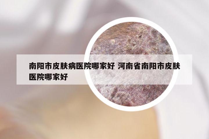 南阳市皮肤病医院哪家好 河南省南阳市皮肤医院哪家好