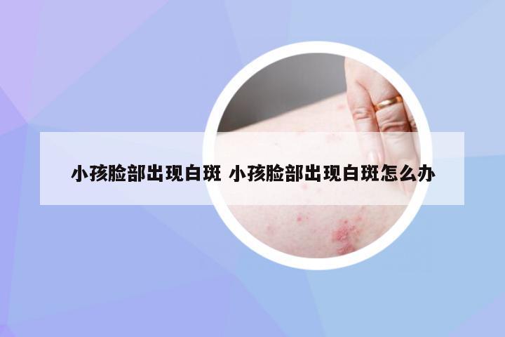 小孩脸部出现白斑 小孩脸部出现白斑怎么办