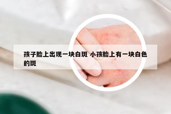 孩子脸上出现一块白斑 小孩脸上有一块白色的斑