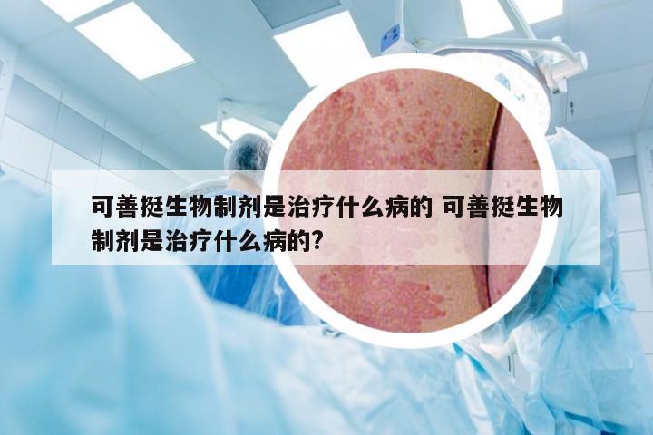 可善挺生物制剂是治疗什么病的 可善挺生物制剂是治疗什么病的?