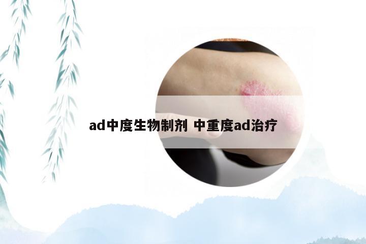 ad中度生物制剂 中重度ad治疗