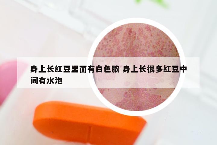 身上长红豆里面有白色脓 身上长很多红豆中间有水泡