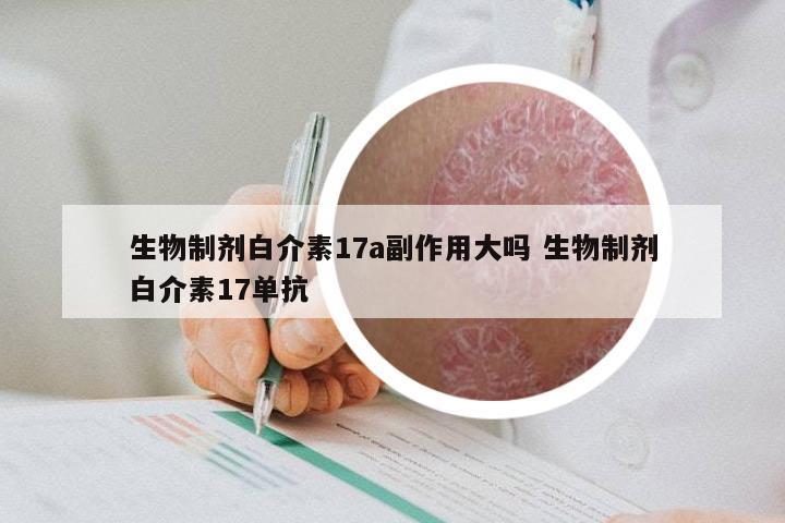 生物制剂白介素17a副作用大吗 生物制剂白介素17单抗