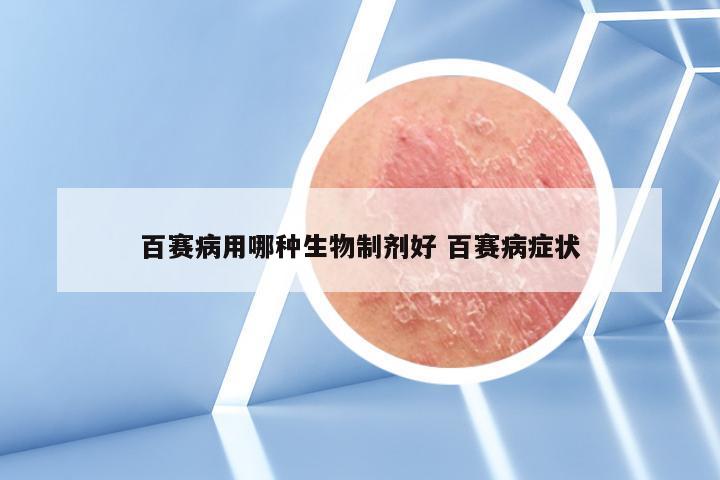 百赛病用哪种生物制剂好 百赛病症状