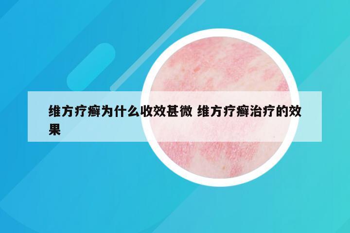 维方疗癣为什么收效甚微 维方疗癣治疗的效果