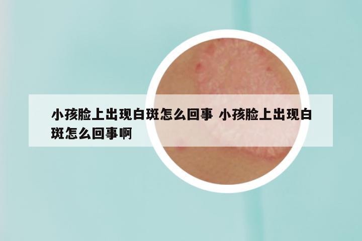 小孩脸上出现白斑怎么回事 小孩脸上出现白斑怎么回事啊