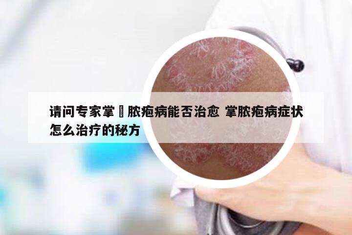 请问专家掌沰脓疱病能否治愈 掌脓疱病症状怎么治疗的秘方