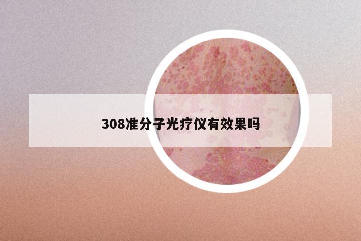 308准分子光疗仪有效果吗