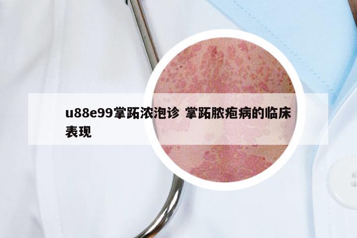 u88e99掌跖浓泡诊 掌跖脓疱病的临床表现