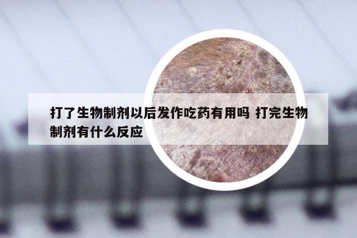 打了生物制剂以后发作吃药有用吗 打完生物制剂有什么反应