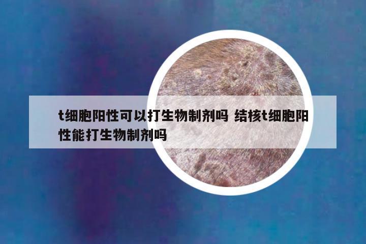 t细胞阳性可以打生物制剂吗 结核t细胞阳性能打生物制剂吗