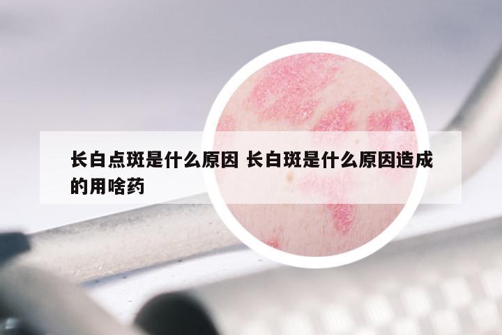 长白点斑是什么原因 长白斑是什么原因造成的用啥药