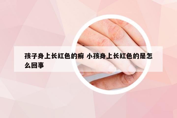 孩子身上长红色的癣 小孩身上长红色的是怎么回事