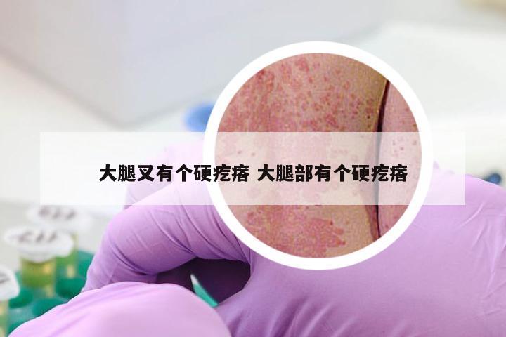 大腿叉有个硬疙瘩 大腿部有个硬疙瘩