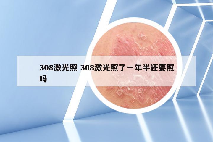 308激光照 308激光照了一年半还要照吗