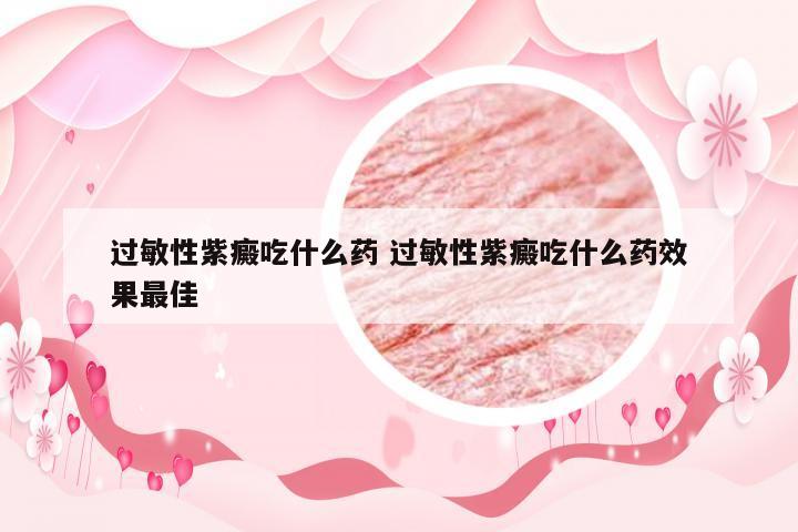 过敏性紫癜吃什么药 过敏性紫癜吃什么药效果最佳