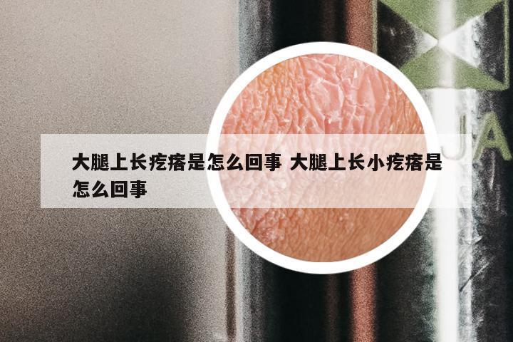 大腿上长疙瘩是怎么回事 大腿上长小疙瘩是怎么回事