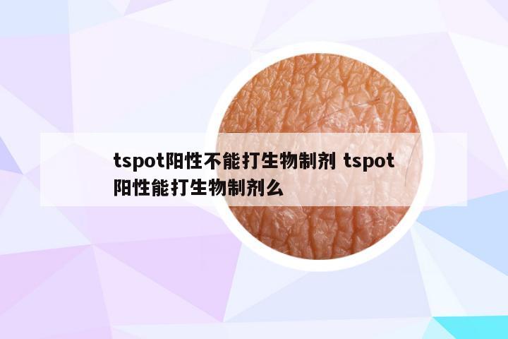 tspot阳性不能打生物制剂 tspot阳性能打生物制剂么