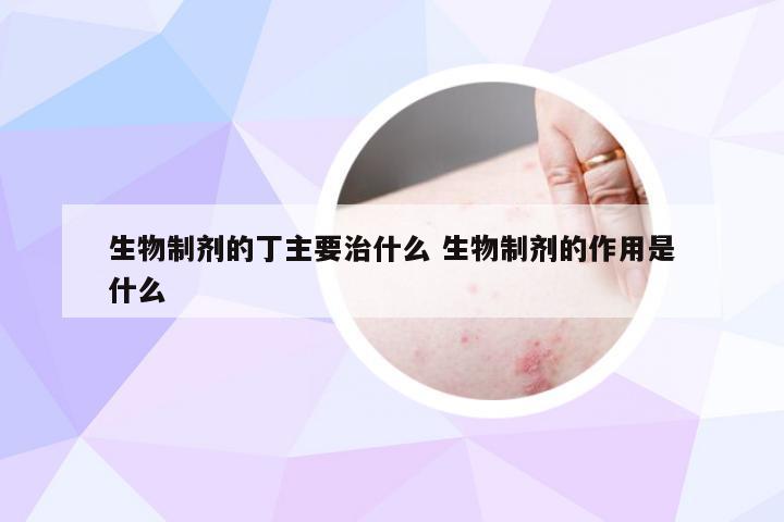 生物制剂的丁主要治什么 生物制剂的作用是什么