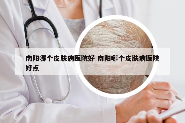 南阳哪个皮肤病医院好 南阳哪个皮肤病医院好点