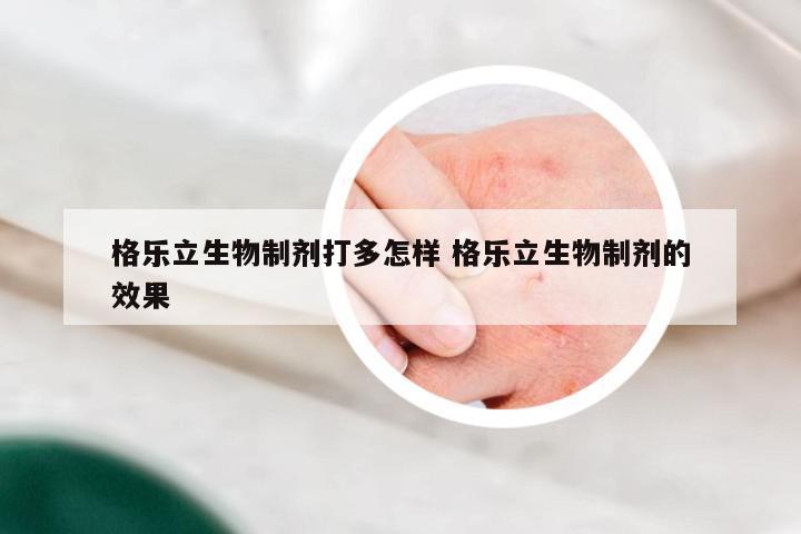 格乐立生物制剂打多怎样 格乐立生物制剂的效果