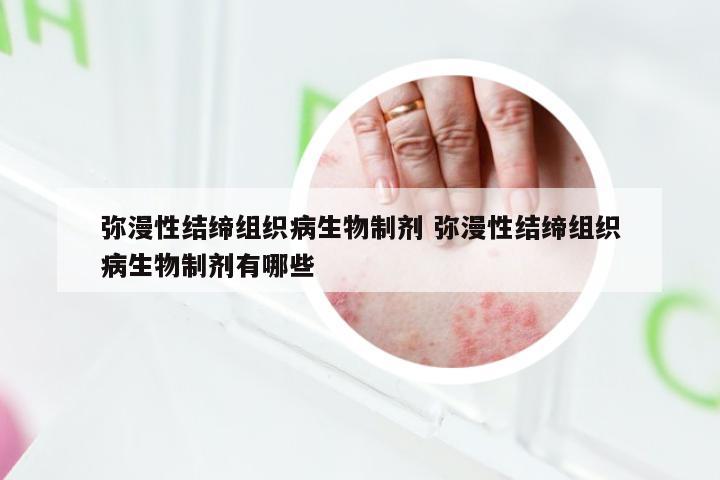 弥漫性结缔组织病生物制剂 弥漫性结缔组织病生物制剂有哪些