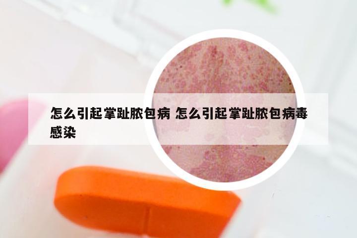 怎么引起掌趾脓包病 怎么引起掌趾脓包病毒感染