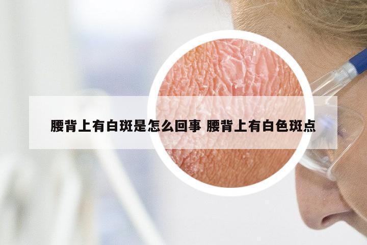 腰背上有白斑是怎么回事 腰背上有白色斑点