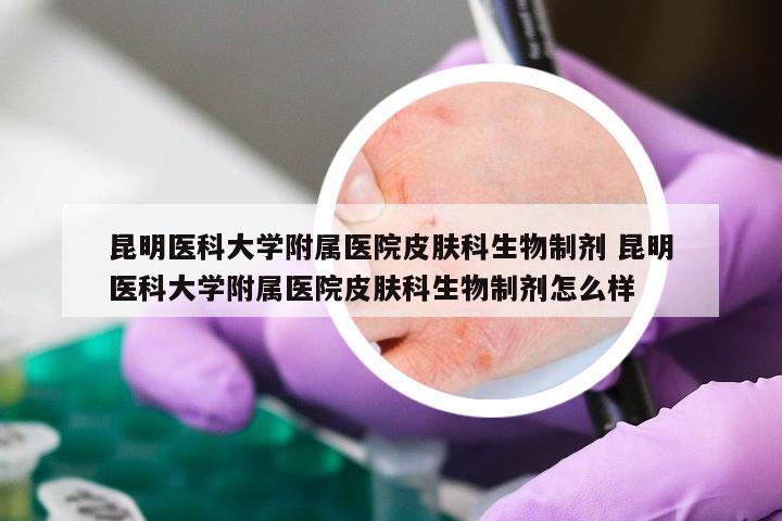 昆明医科大学附属医院皮肤科生物制剂 昆明医科大学附属医院皮肤科生物制剂怎么样