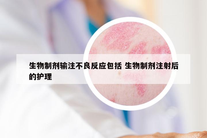 生物制剂输注不良反应包括 生物制剂注射后的护理