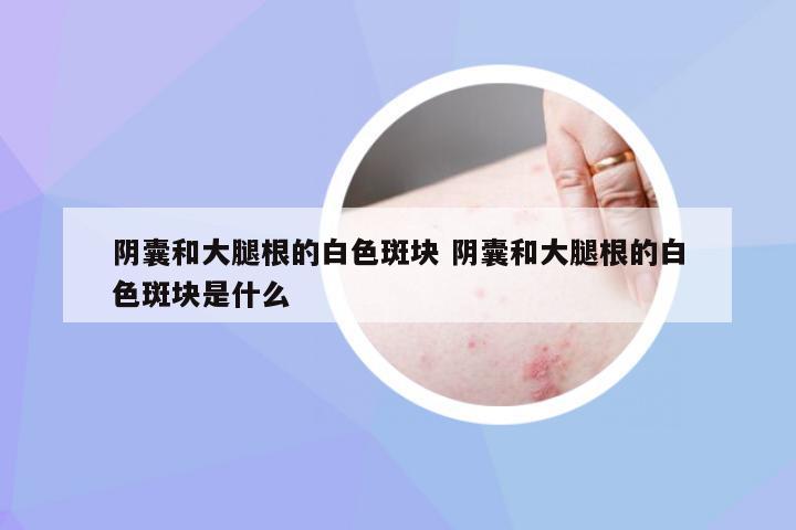 阴囊和大腿根的白色斑块 阴囊和大腿根的白色斑块是什么