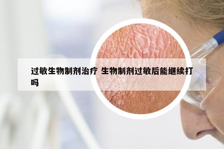 过敏生物制剂治疗 生物制剂过敏后能继续打吗