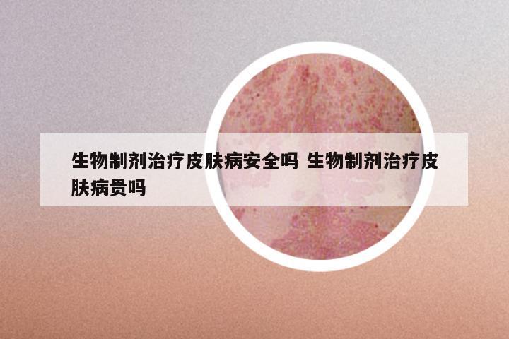 生物制剂治疗皮肤病安全吗 生物制剂治疗皮肤病贵吗