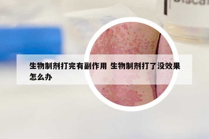 生物制剂打完有副作用 生物制剂打了没效果怎么办