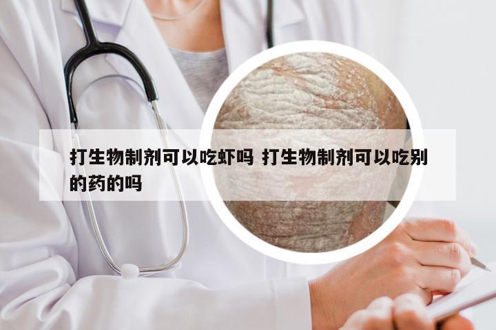 打生物制剂可以吃虾吗 打生物制剂可以吃别的药的吗