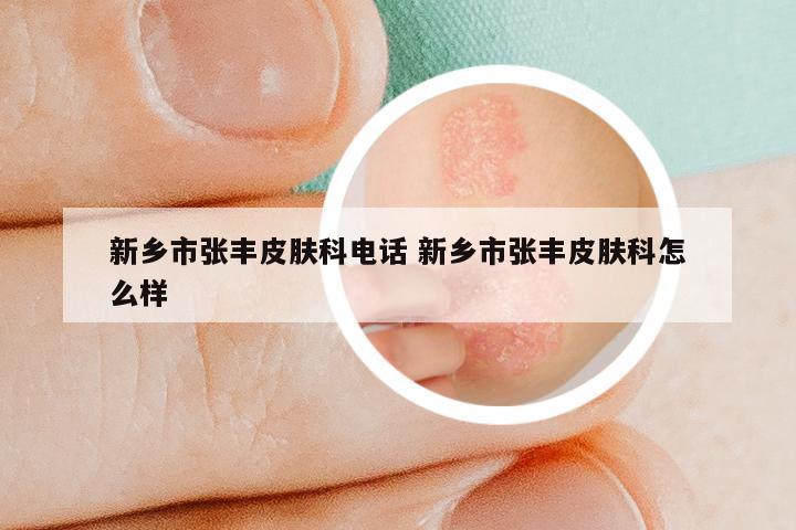 新乡市张丰皮肤科电话 新乡市张丰皮肤科怎么样