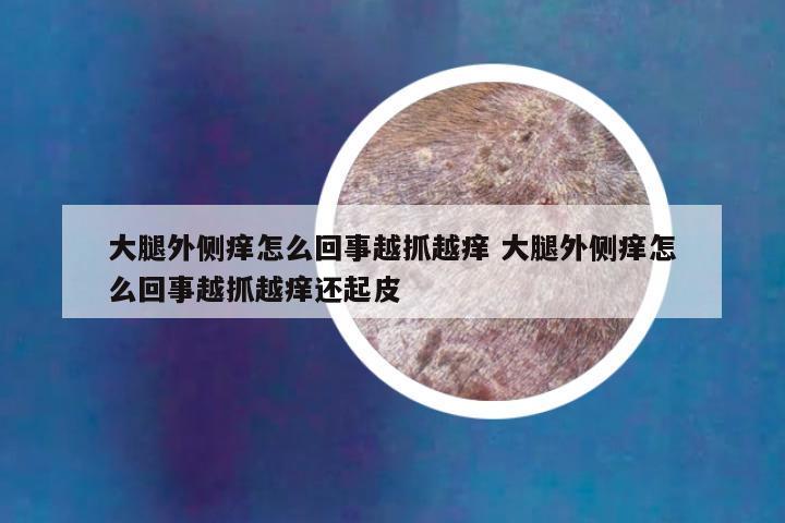 大腿外侧痒怎么回事越抓越痒 大腿外侧痒怎么回事越抓越痒还起皮