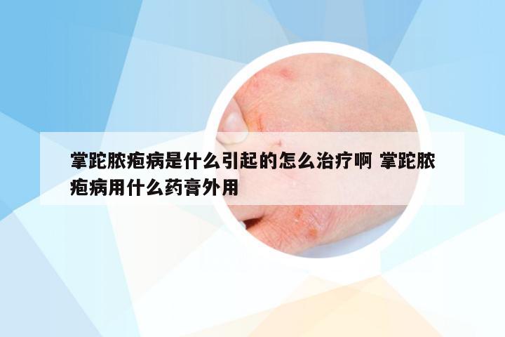 掌跎脓疱病是什么引起的怎么治疗啊 掌跎脓疱病用什么药膏外用