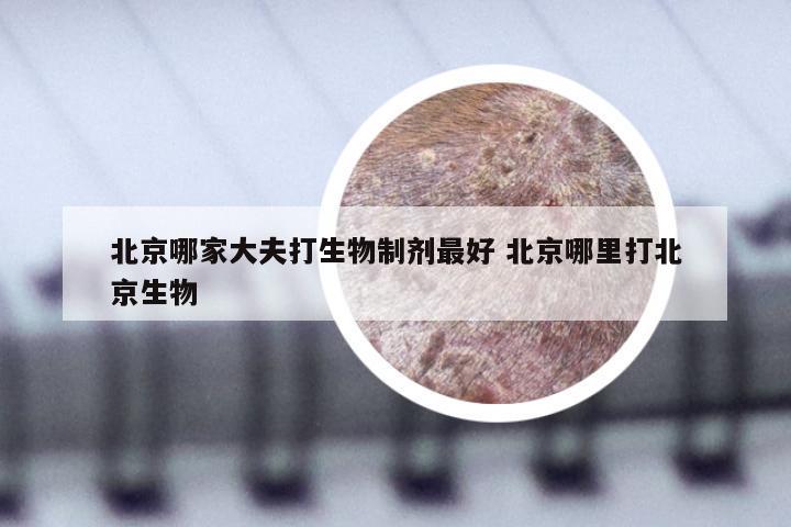 北京哪家大夫打生物制剂最好 北京哪里打北京生物