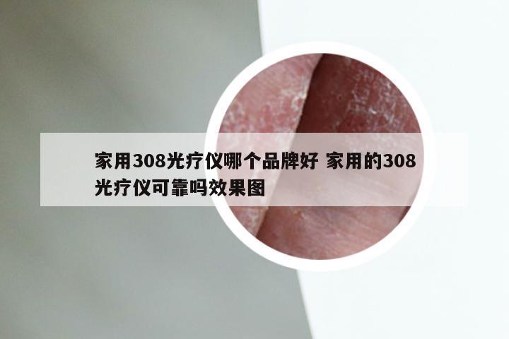 家用308光疗仪哪个品牌好 家用的308光疗仪可靠吗效果图