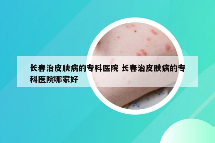 长春治皮肤病的专科医院 长春治皮肤病的专科医院哪家好