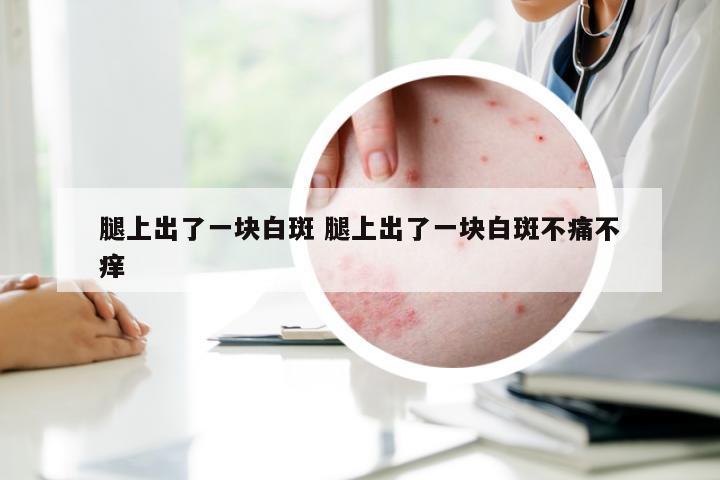 腿上出了一块白斑 腿上出了一块白斑不痛不痒