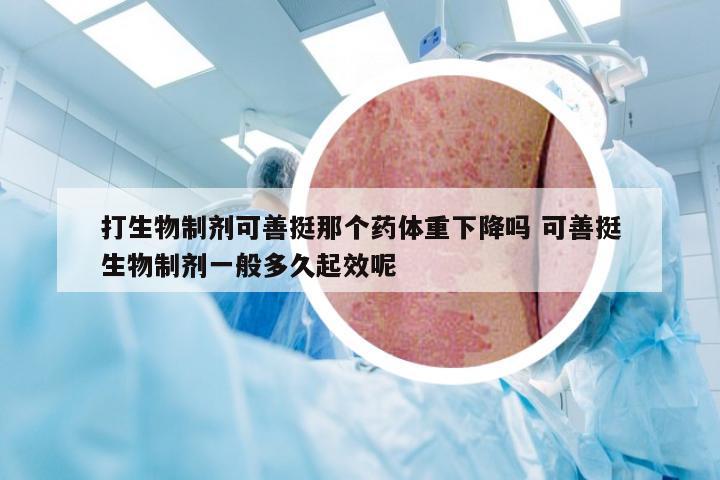 打生物制剂可善挺那个药体重下降吗 可善挺生物制剂一般多久起效呢