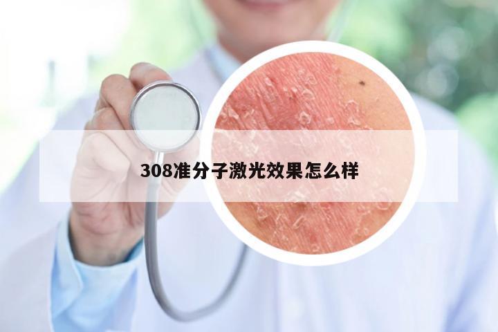 308准分子激光效果怎么样