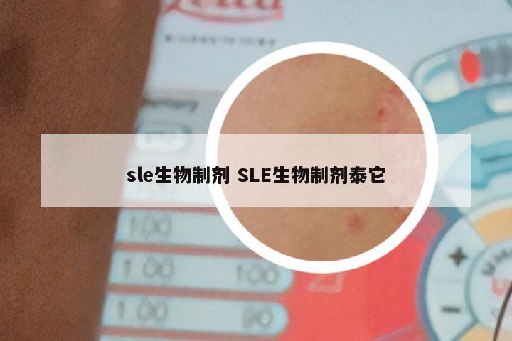 sle生物制剂 SLE生物制剂泰它