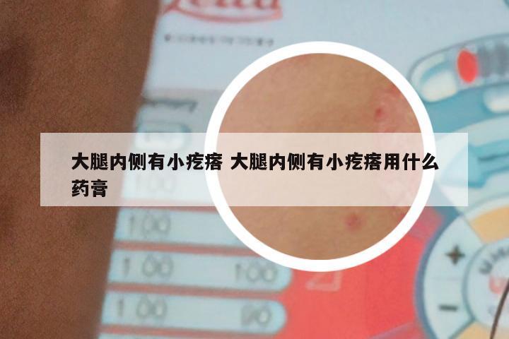 大腿内侧有小疙瘩 大腿内侧有小疙瘩用什么药膏