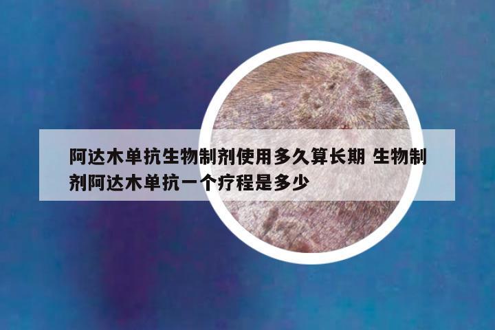 阿达木单抗生物制剂使用多久算长期 生物制剂阿达木单抗一个疗程是多少