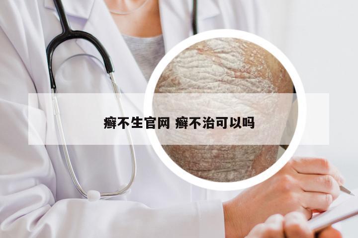 癣不生官网 癣不治可以吗