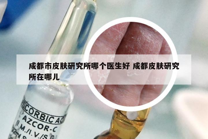 成都市皮肤研究所哪个医生好 成都皮肤研究所在哪儿