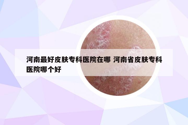 河南最好皮肤专科医院在哪 河南省皮肤专科医院哪个好